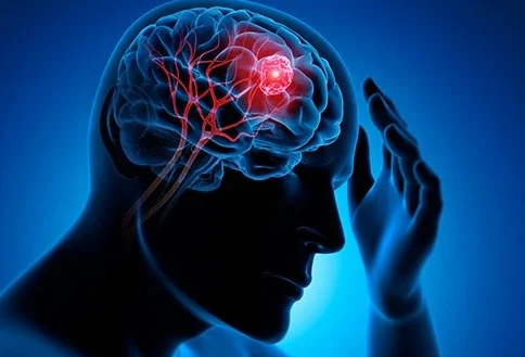 什么是神经细胞瘤？一种常见的神经系统肿瘤