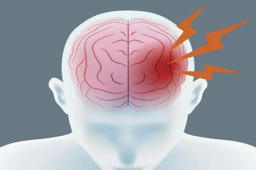 脑水肿和颅高压的关系，都是严重的神经系统疾病