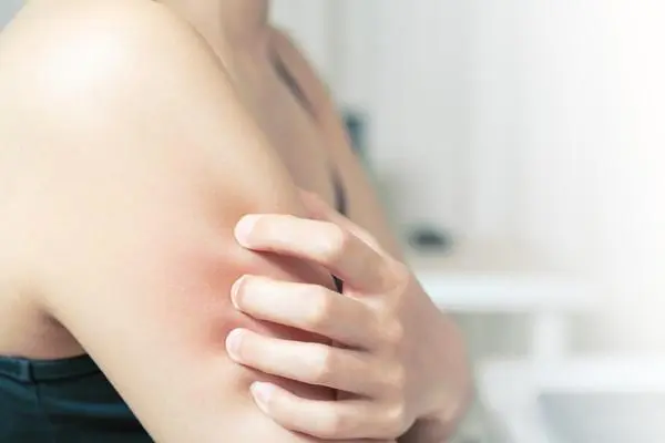 皮肤瘙痒没有任何症状就是痒，缓解瘙痒的方法