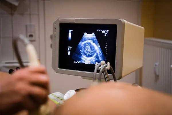 前置胎盘是什么意思，妊娠期间胎盘位于子宫的前壁