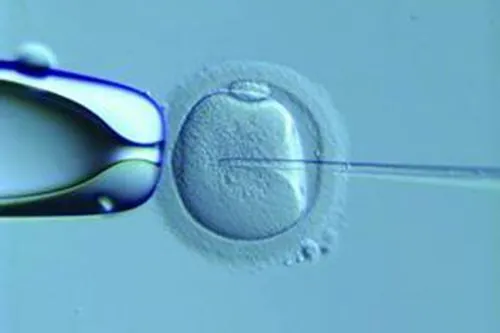 人工授精可以选择男女吗，人工授精可以选择受精卵的性别
