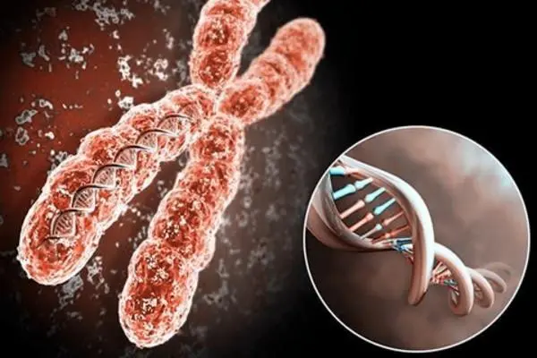 瑞氏综合征是怎么引起，染色体异常引起的遗传性疾病