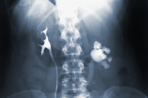 X-ray image