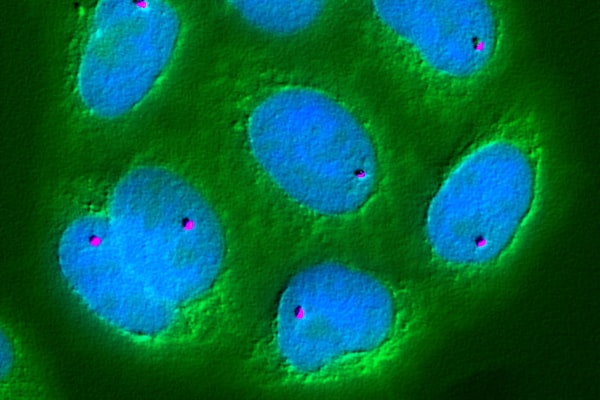 gene coding